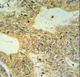 Polyclonal Rabbit anti-Human CLDN23 / Claudin 23 Antibody (aa228-257, IHC, WB)