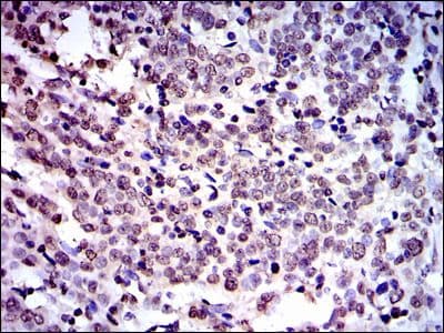 Monoclonal Mouse anti-Human NEDD8 Antibody (clone 1A7, IHC, IF, WB)