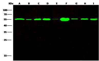 TUBB / Beta Tubulin Antibody (clone 05, Preservative Free)