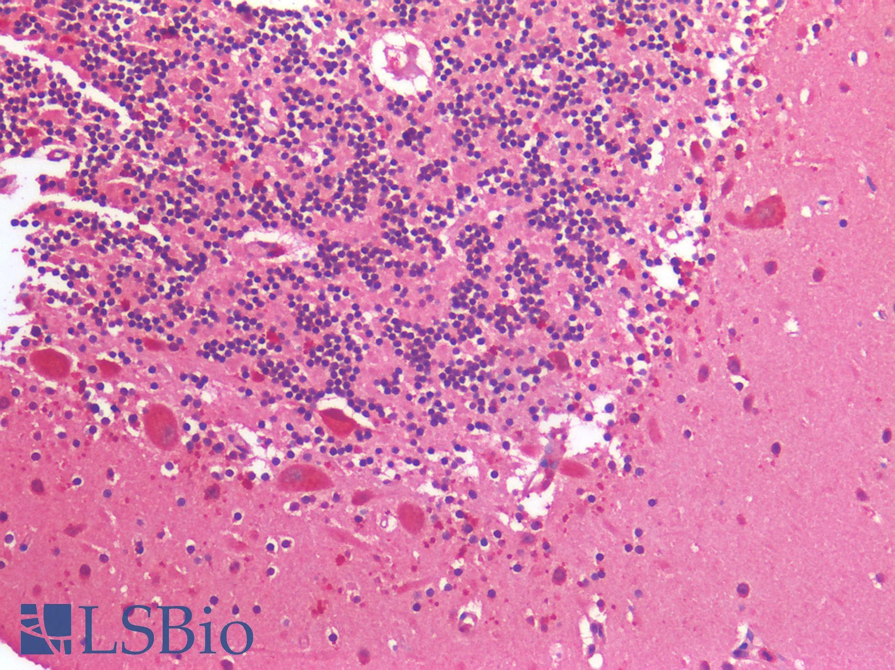 IHC-plus™ IGF1R / IGF1 Receptor Antibody