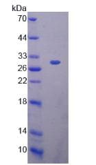 Human PRDX4 / Peroxiredoxin 4 Protein (Recombinant His)