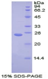 Human TNPO1 / Transportin 1 Protein (Recombinant His)