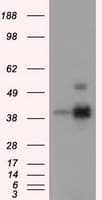 ERCC1 Antibody (clone OTI1B3)