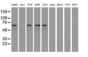 IGF2BP2 Antibody (clone OTI3C8)