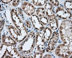 Monoclonal Mouse anti-Human NPR3 Antibody (clone OTI11H6, IHC, IF, WB)