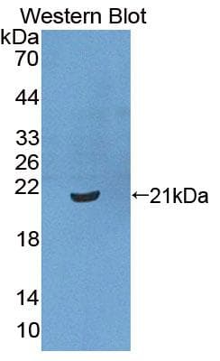 XPO1 / CRM1 Antibody (aa917-1071)