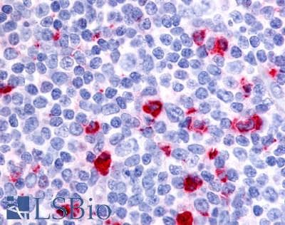 IHC-plus™ MST1R / RON Antibody (Internal)