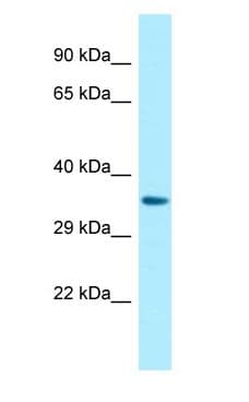 P2RY14 / GPR105 Antibody (aa218-267)