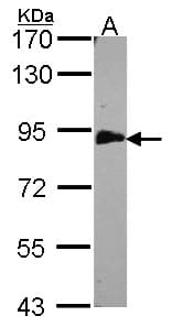 EML1 / EMAP Antibody (aa753-815)