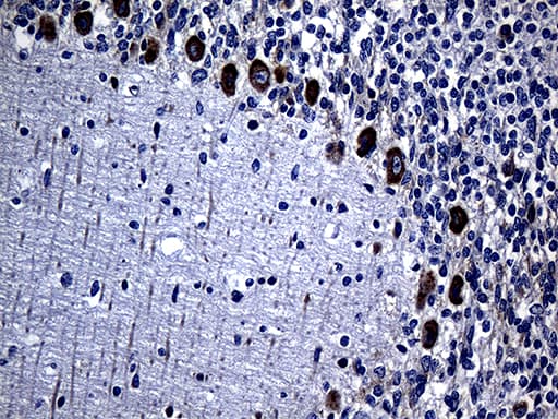 Monoclonal Mouse anti-Human MMGT1 Antibody (clone OTI4D7, IHC, WB)