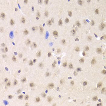 PRPF3 Antibody