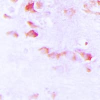 SYN1 / Synapsin 1 Antibody (phospho-Ser9)