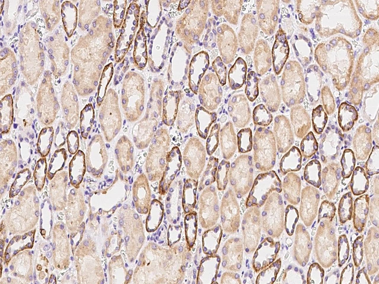 FACL2 / ACSL1 Antibody