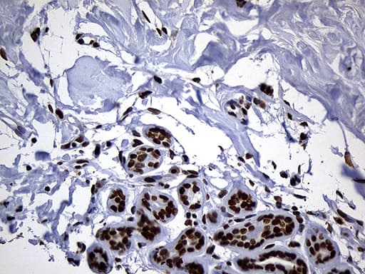 ALOX5 / 5-LOX Antibody (aa18-364, clone OTI1A1)