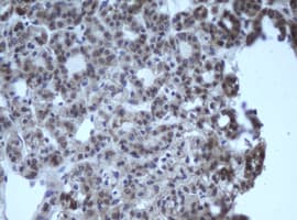 CBX8 Antibody (clone OTI5F3)