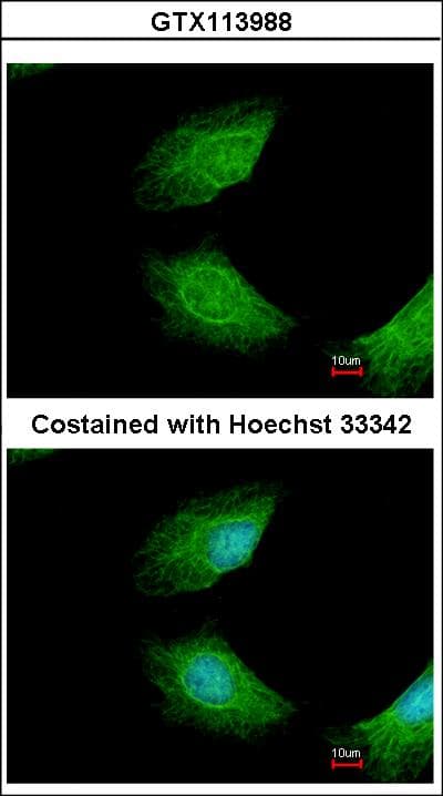 CIAPIN1 / Anamorsin Antibody (aa72-297)