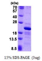 Human RPS10 / Ribosomal Protein S10 (Recombinant His)