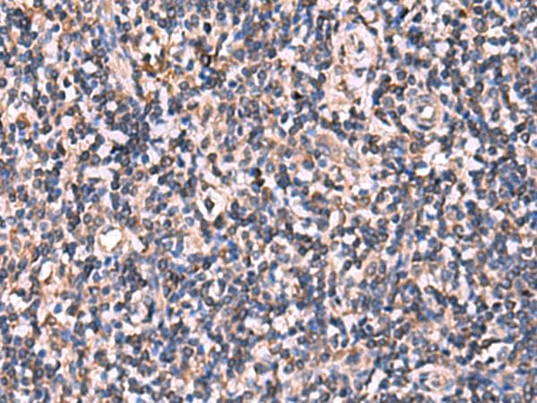 Polyclonal Rabbit anti-Human RHAG Antibody (IHC, WB)