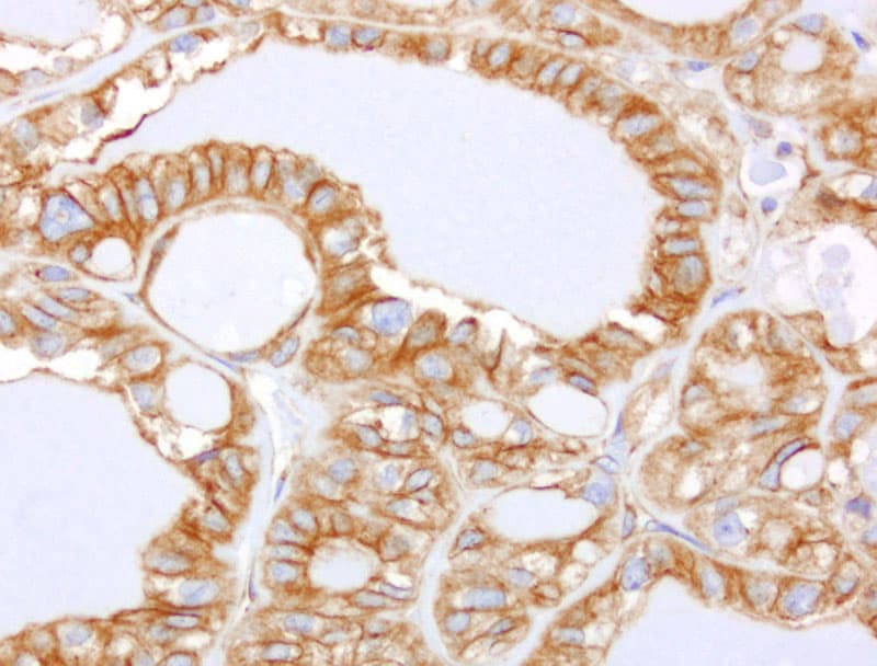 CDH2 / N Cadherin Antibody (clone UMAB23, Carrier-free)