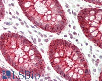 SLC39A5 / ZIP5 Antibody (N-Terminus)