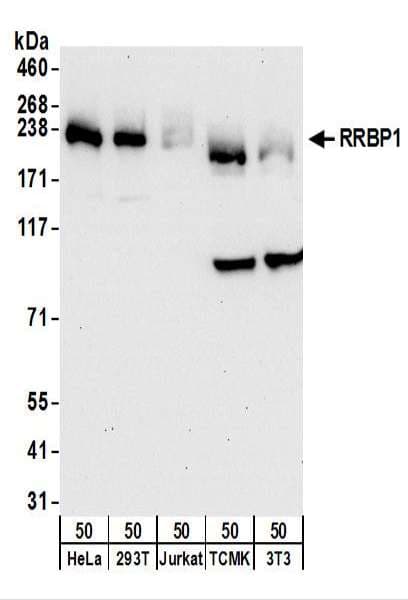 IHC-plus™ Polyclonal Rabbit anti-Human RRBP1 / hES Antibody (aa1490-1540, IHC, WB)