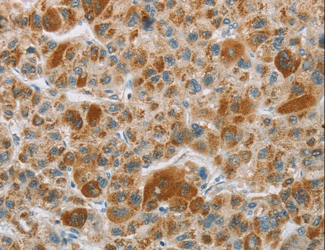 CYP27 / CYP27A1 Antibody