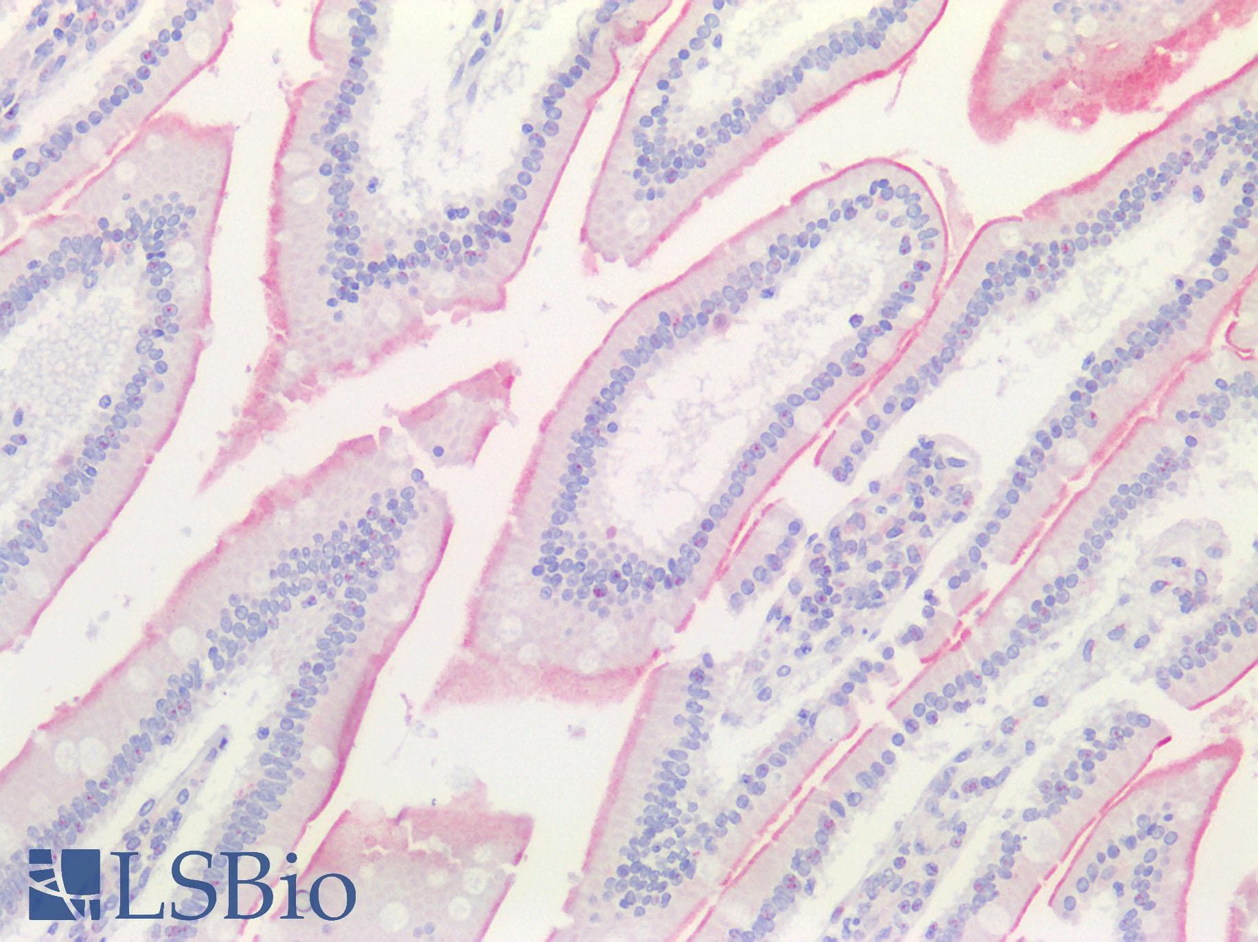 SLC6A19 Antibody (C-Terminus)