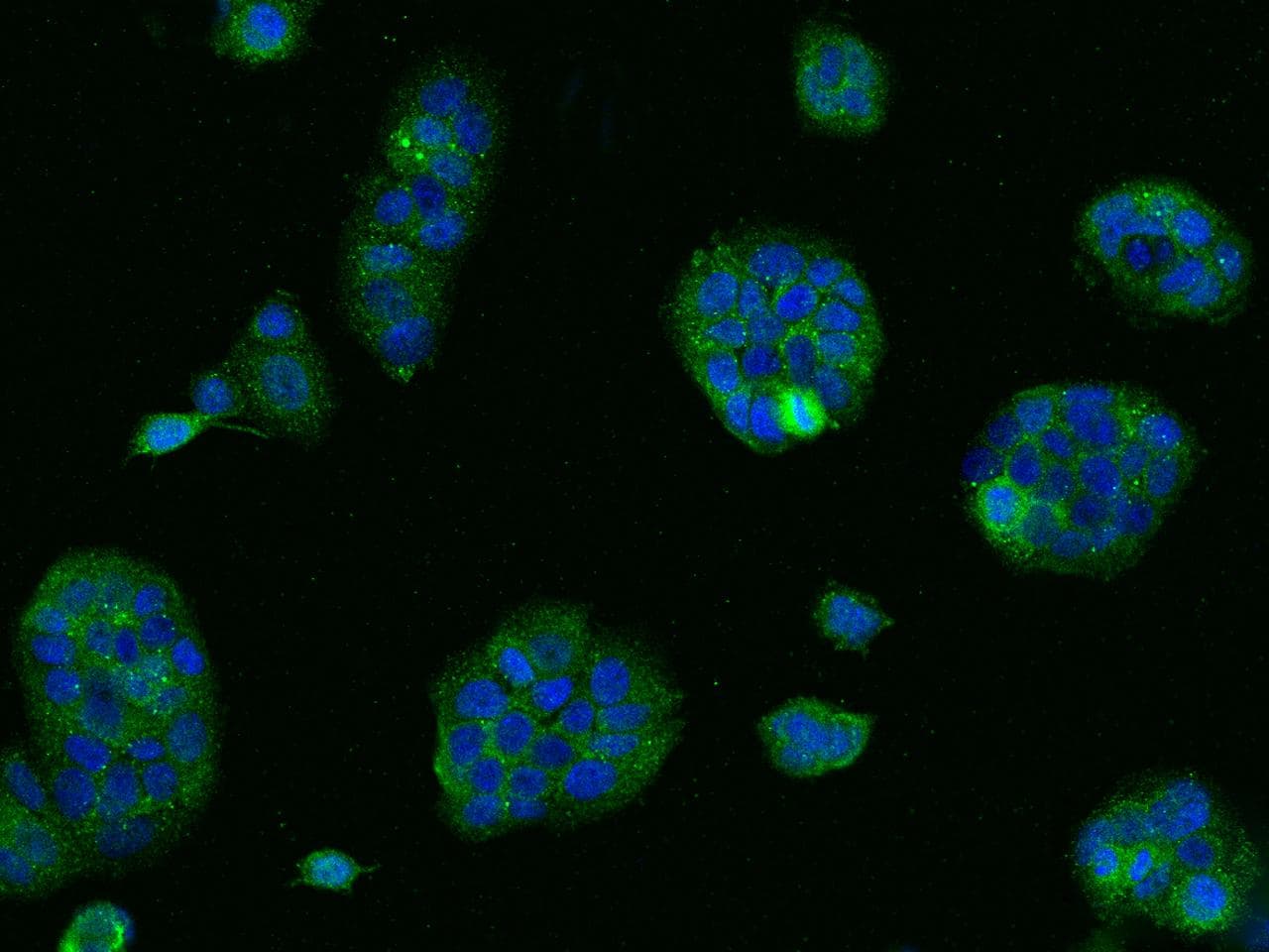 FPR1 / FPR Antibody