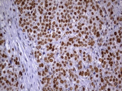 MSH2 Antibody (aa1-304, clone UMAB259)