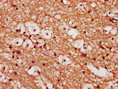 YWHAQ / 14-3-3 Theta Antibody (aa1-245)