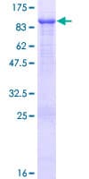 Human FERMT1 / Kindlin Protein (Recombinant GST)