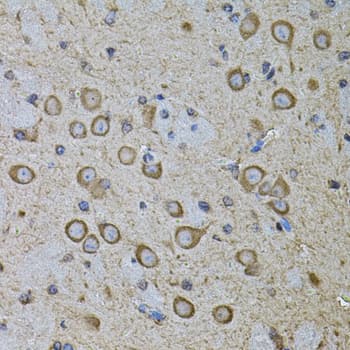 CDH16 / Cadherin 16 Antibody