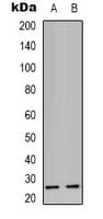 SCN4B Antibody (Internal)