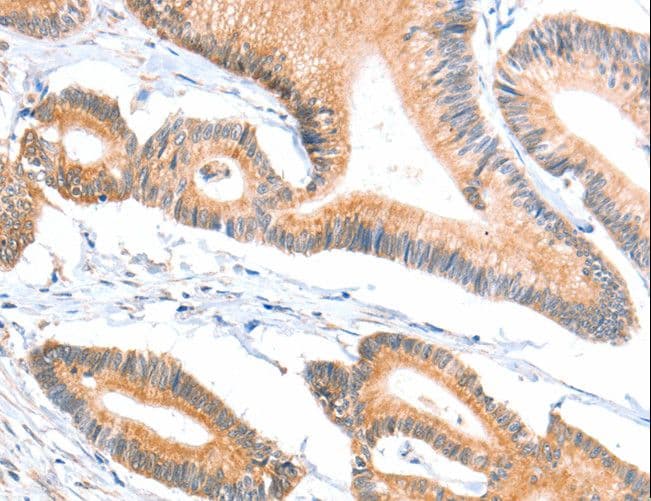 ACSBG1 / hsBG Antibody