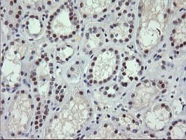 SOLO / SESTD1 Antibody (clone OTI2E7)