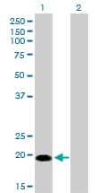 CETN1 Antibody (clone 2A6)
