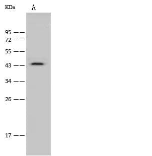 CCR6 Antibody (Preservative Free)