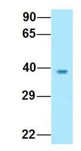 KIR2DL5A / KIR2DL5 Antibody (aa300-349)