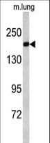ALS2 / Alsin Antibody (aa1248-1277)