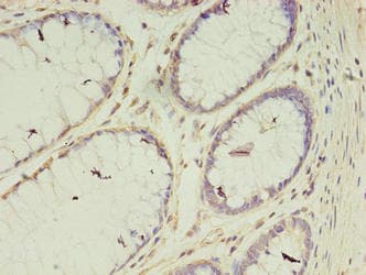VASH2 Antibody