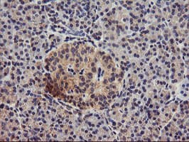 DGKA Antibody (clone OTI4A11, Carrier-free)
