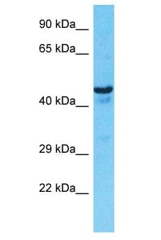Polyclonal Rabbit anti-Human OXER1 Antibody (aa363-412, WB)