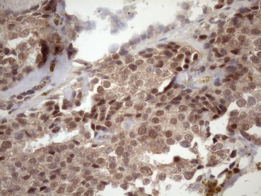 TDG / Thymine DNA Glycosylase Antibody (aa160-253, clone OTI3A12)