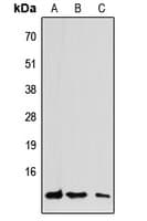 Polyclonal Rabbit anti-Human CCL7 / MCP3 Antibody (C-Terminus, WB)