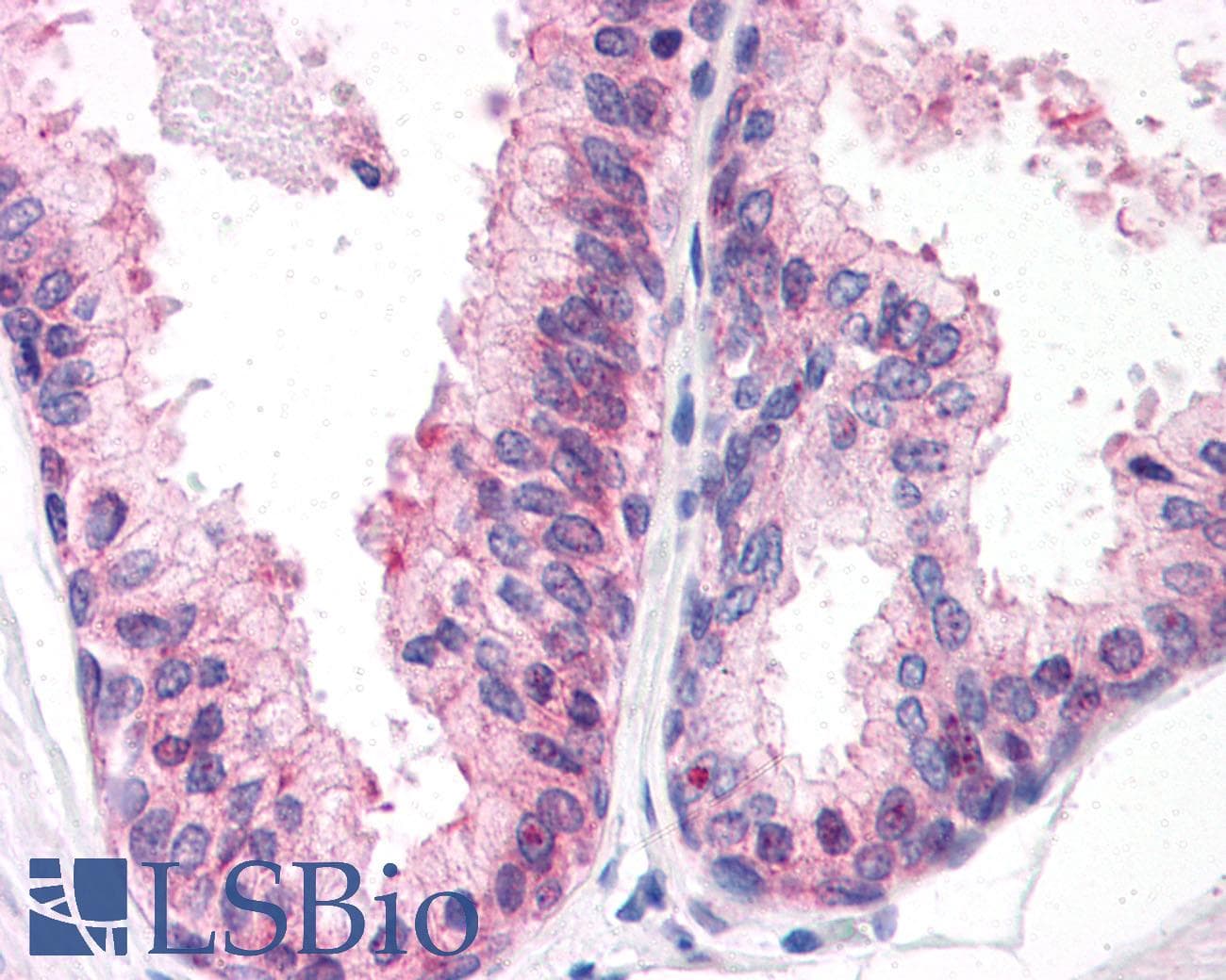 IHC-plus™ ENPP3 / CD203c Antibody (C-Terminus)