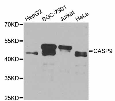 Polyclonal Rabbit anti-Human CASP9 / Caspase 9 Antibody (IHC, IF, WB)