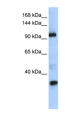 TUT1 Antibody (aa829-878)