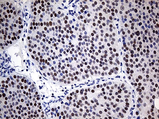 ZNF2 Antibody (clone OTI1G3)