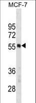 PTBP1 Antibody (aa26-55)