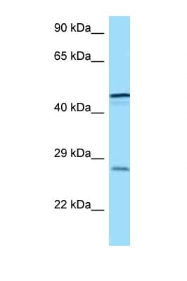 TREM1 Antibody (aa162-211)